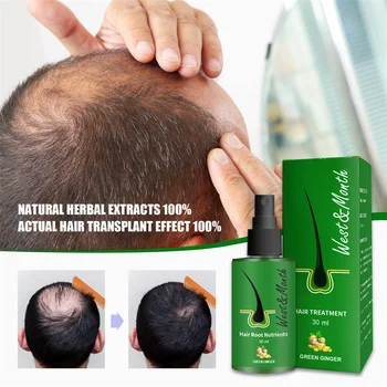 2023 Plaukų Augimą, Naftos Greitą Plaukų Augimą Produktų Galvos odos Gydymo Kelią Plaukų Slinkimas ir Retinimo Plaukų Grožio Priežiūros Vyrams, Moterims 30ml